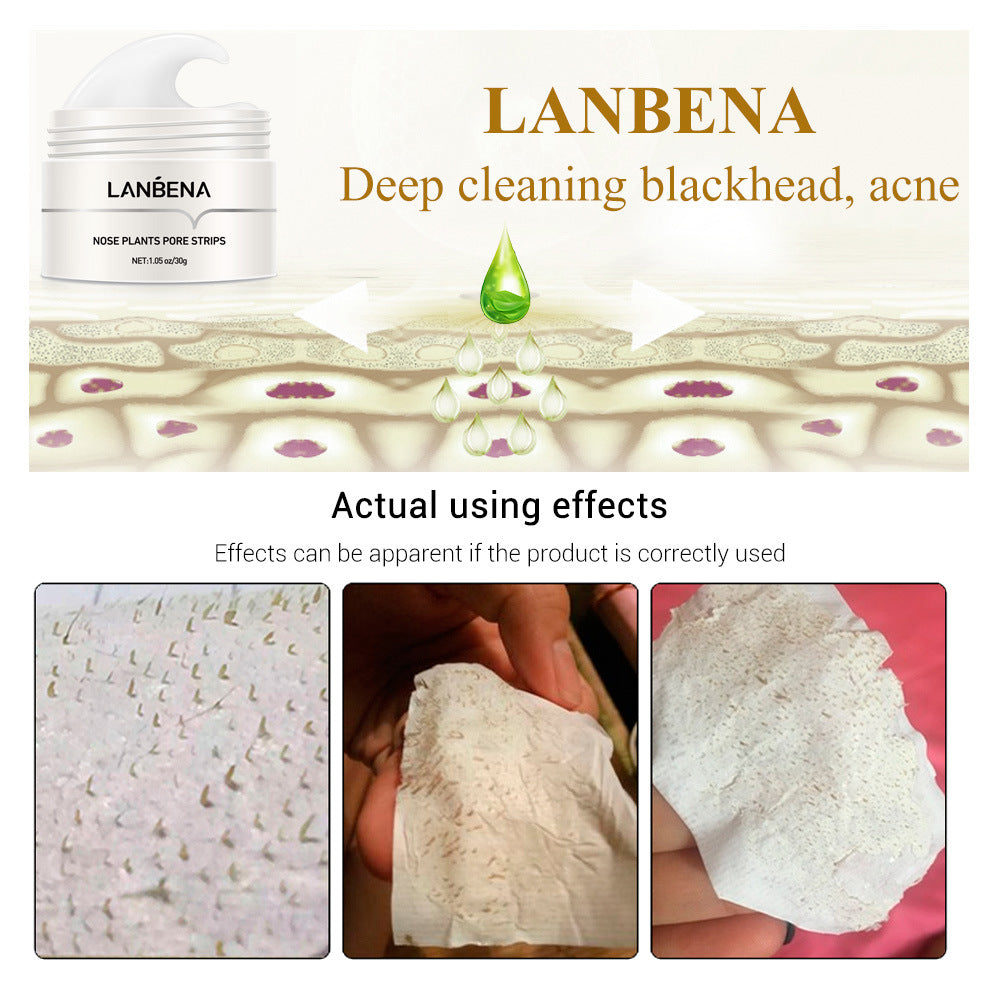 Blackhead Nasal Membrane Sucking Blackhead Tearing To Remove Acne - TrendsfashionIN