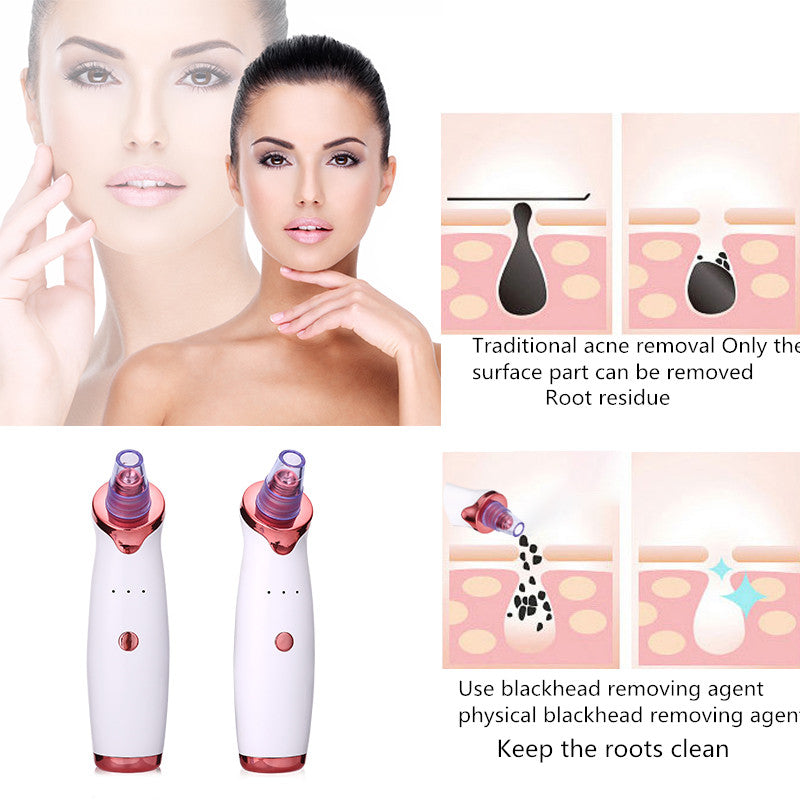 Blackhead Remover Instrument Black Dot Remover Acne Vacuum Suction. - TrendsfashionIN